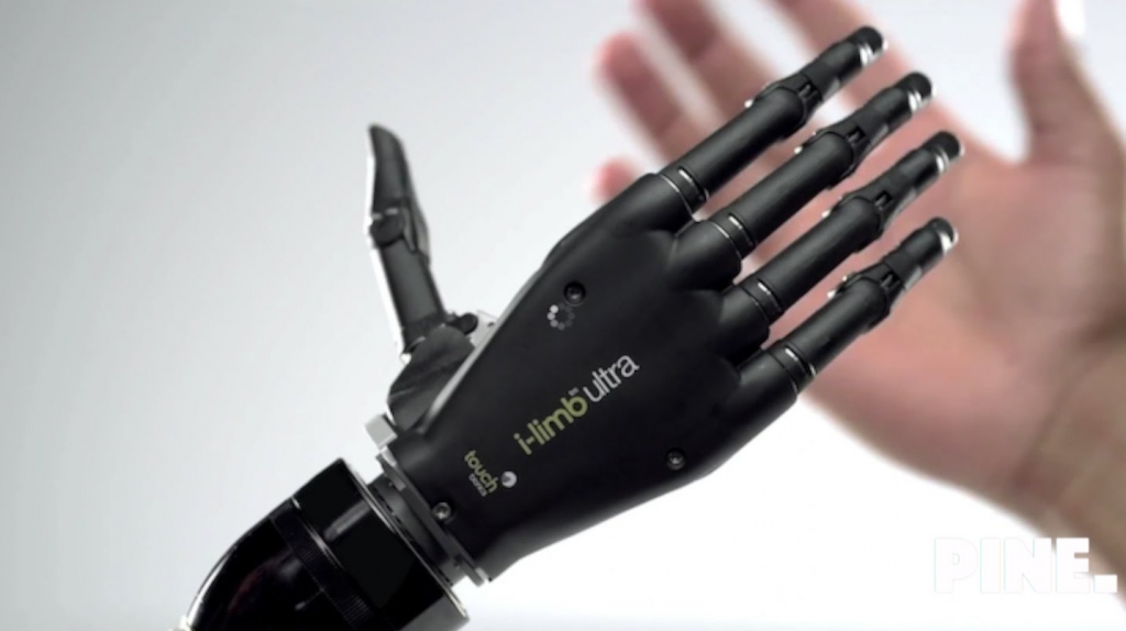 A Brief Discussion On Bionic Arm