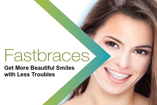 Fastbraces - Get More Beautiful Smiles With Less Troubles