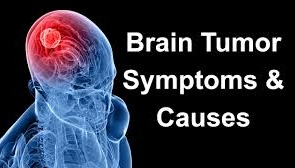 Brain Tumor: Know The Symptoms and Treatments Available